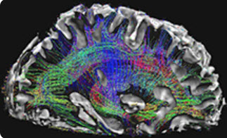 image de r�sonance magn�tique du cerveau
